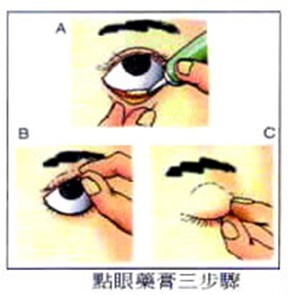 涂于眼下睑穹窿部图图片